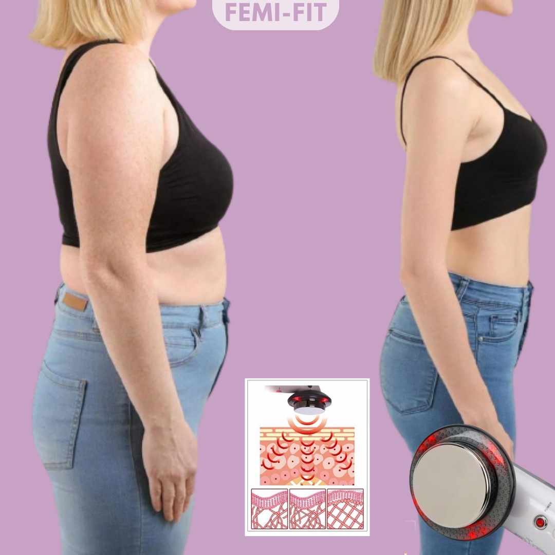 3-w-1 Usuwacz weterynaryjny i cellulitowy - SlimShape-Trend Polska
