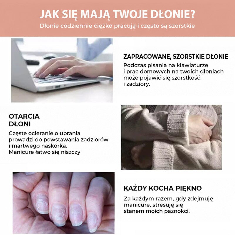 Grafika z trzema sytuacjami obciążającymi dłonie: pisanie na laptopie, tarcie o ubranie i zniszczone paznokcie 6