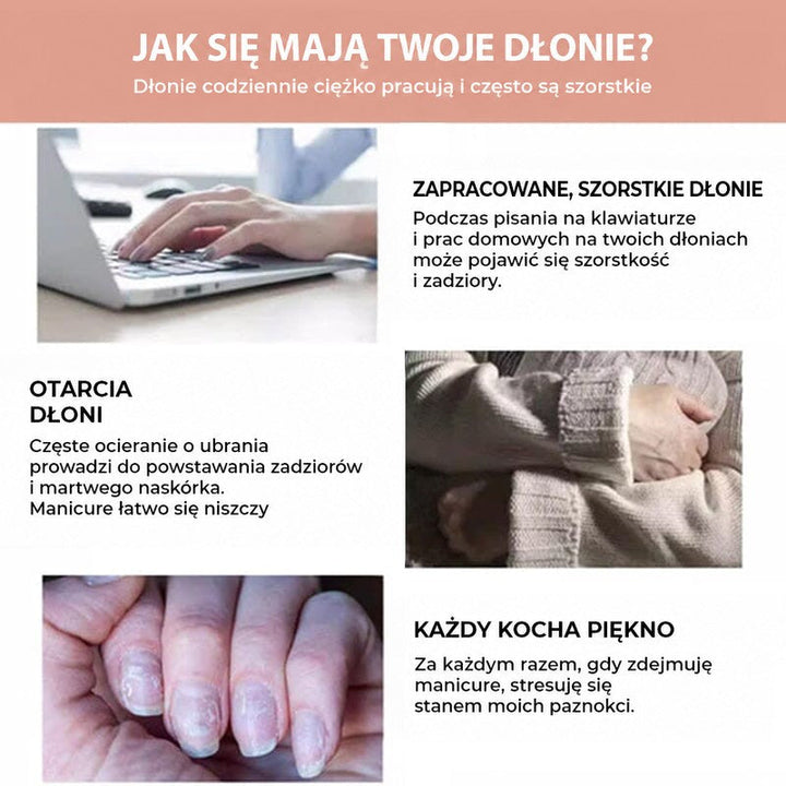 Grafika z trzema sytuacjami obciążającymi dłonie: pisanie na laptopie, tarcie o ubranie i zniszczone paznokcie 6