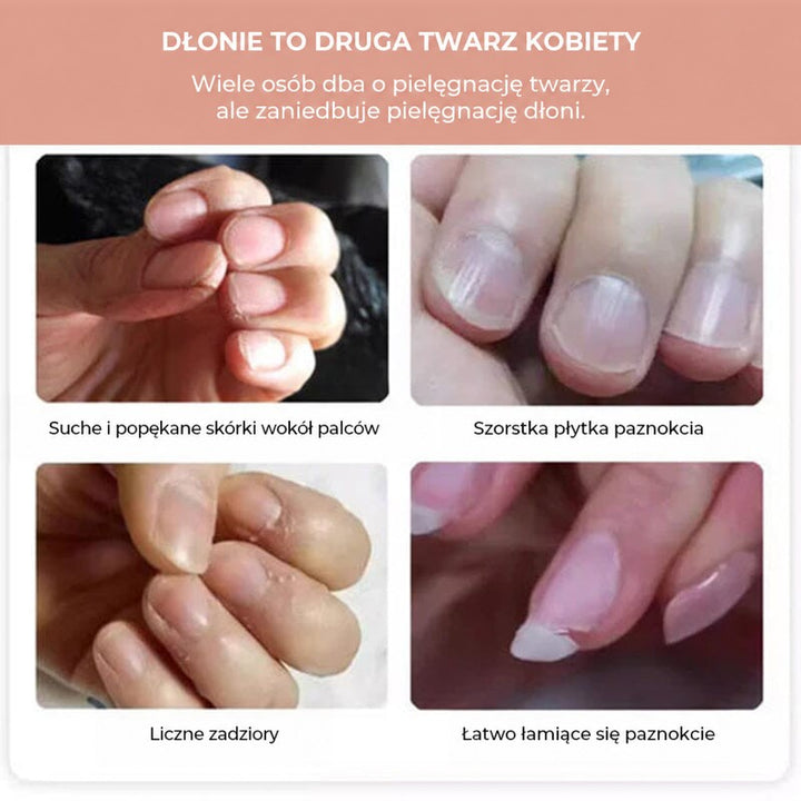 Grafika z czterema zdjęciami problemów dłoni: suche skórki, szorstka płytka, zadziory i łamliwe paznokcie 3