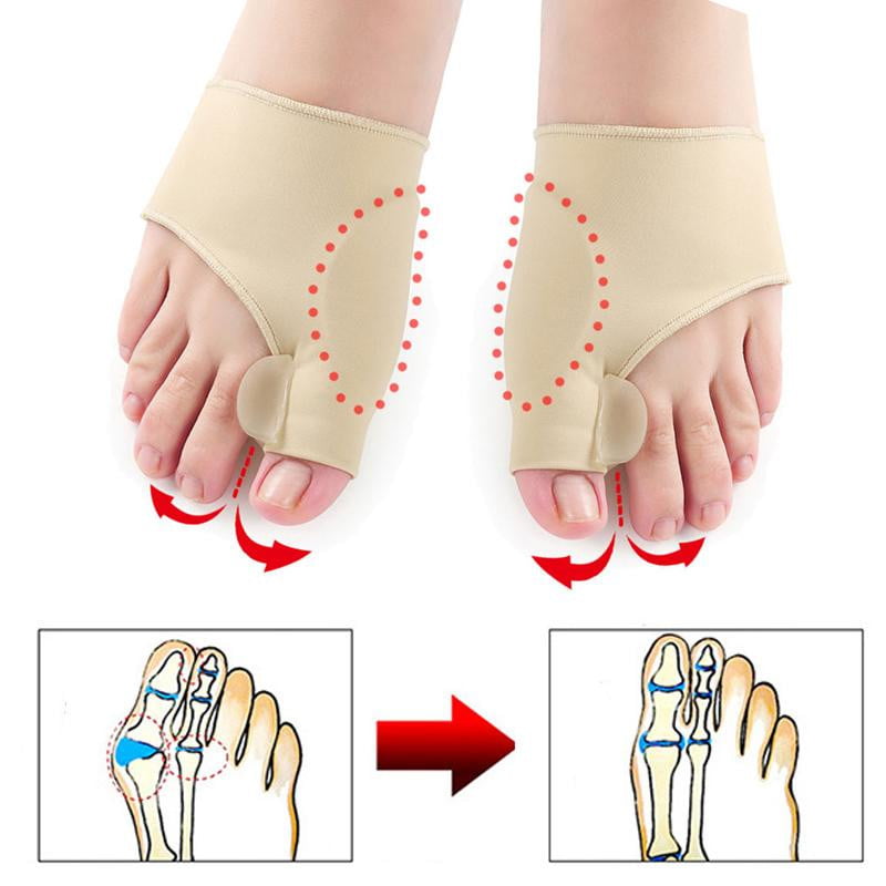 Hallux Valgus Ochraniacz (1 para) - OrthoBunion-Trend Polska