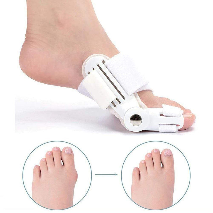 Korektor szpotkowy na Hallux Valgus (1 para) - BunionFix-Biały-Trend Polska
